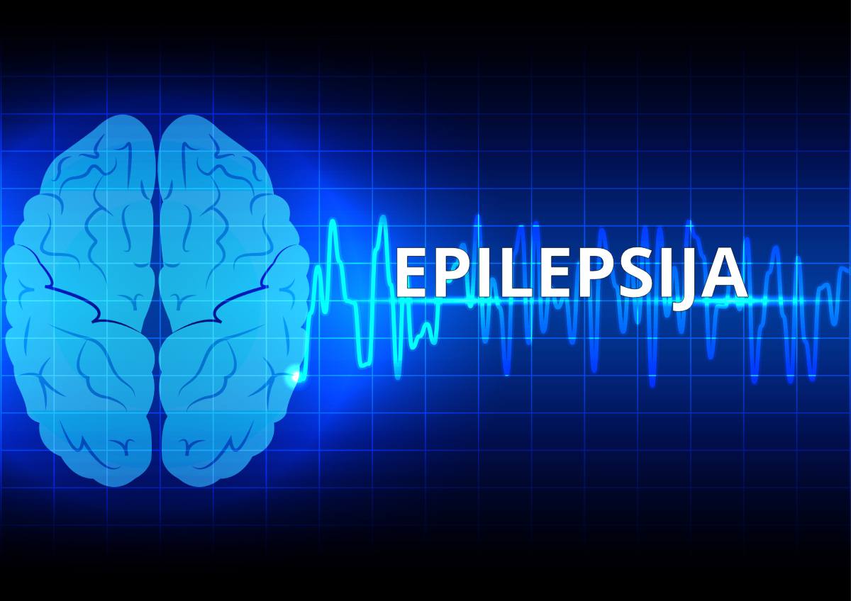 Šta je epilepsija